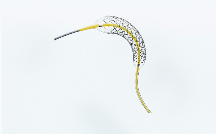 Neurovascular Stents